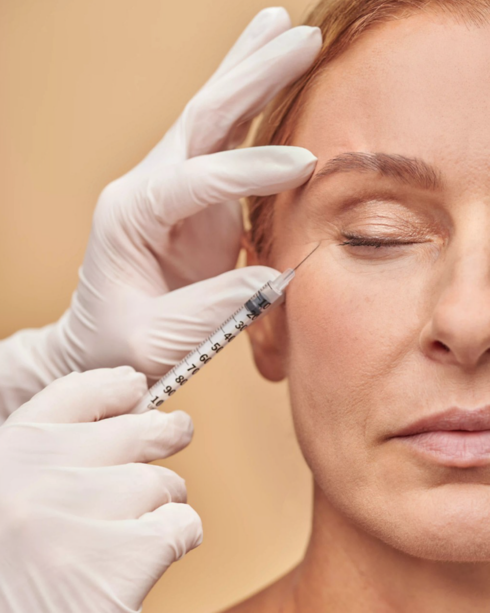 NP BOTOX